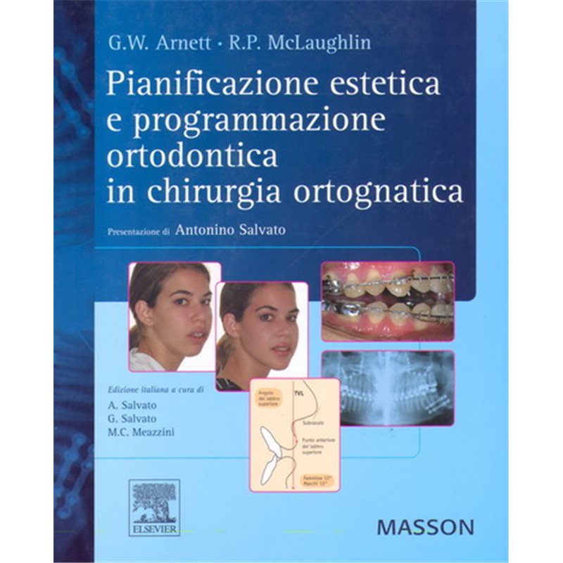 Pianificazione dentale e facciale in chirurgia ortognatodontica